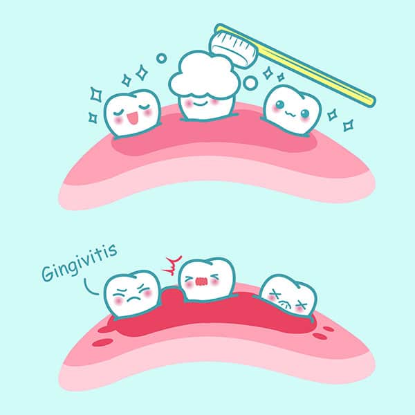 Periodontal Dentistry Etobicoke